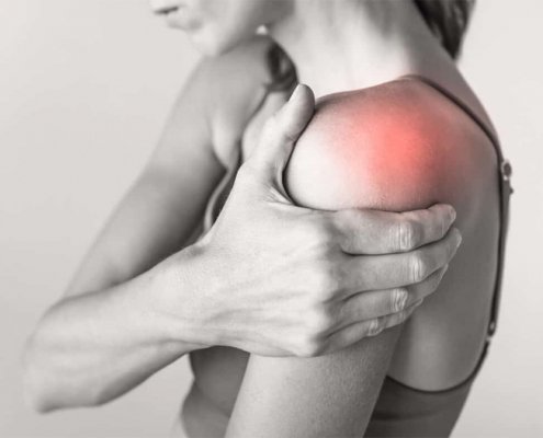 Bursitis